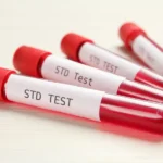 How to Talk to Your Partner About STD Screening