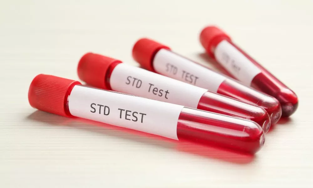 How to Talk to Your Partner About STD Screening